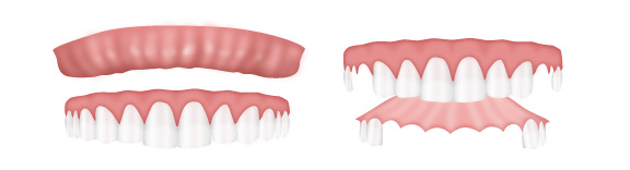 removable-dentures.jpg